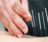 Acupuntura em Savassi